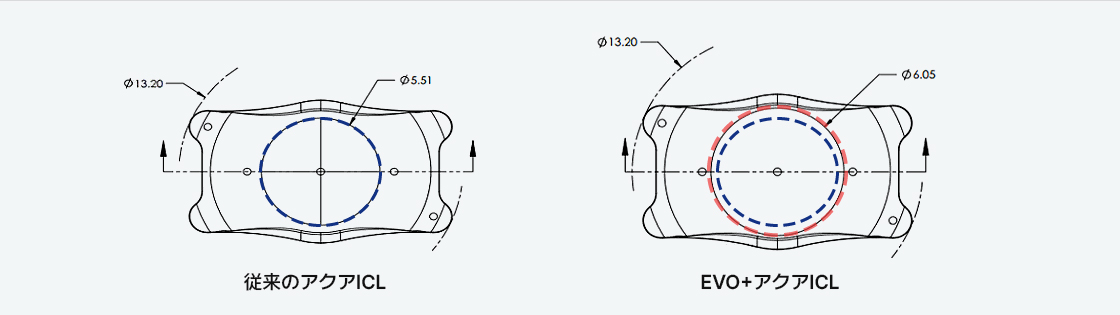 기존 아쿠아 ICL EVO＋AQUA ICL 비교 이미지